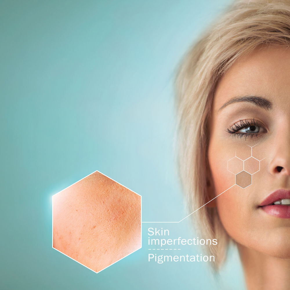 Taking Skin Imperfections to the next level